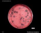 Beta and gamma hemolysis on blood agar